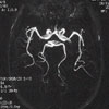 Brain scan of Circle of Willis