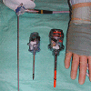 Laparoscopic Equipment